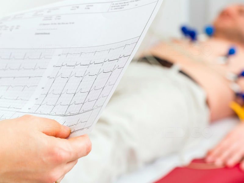 ELectrocardiograma